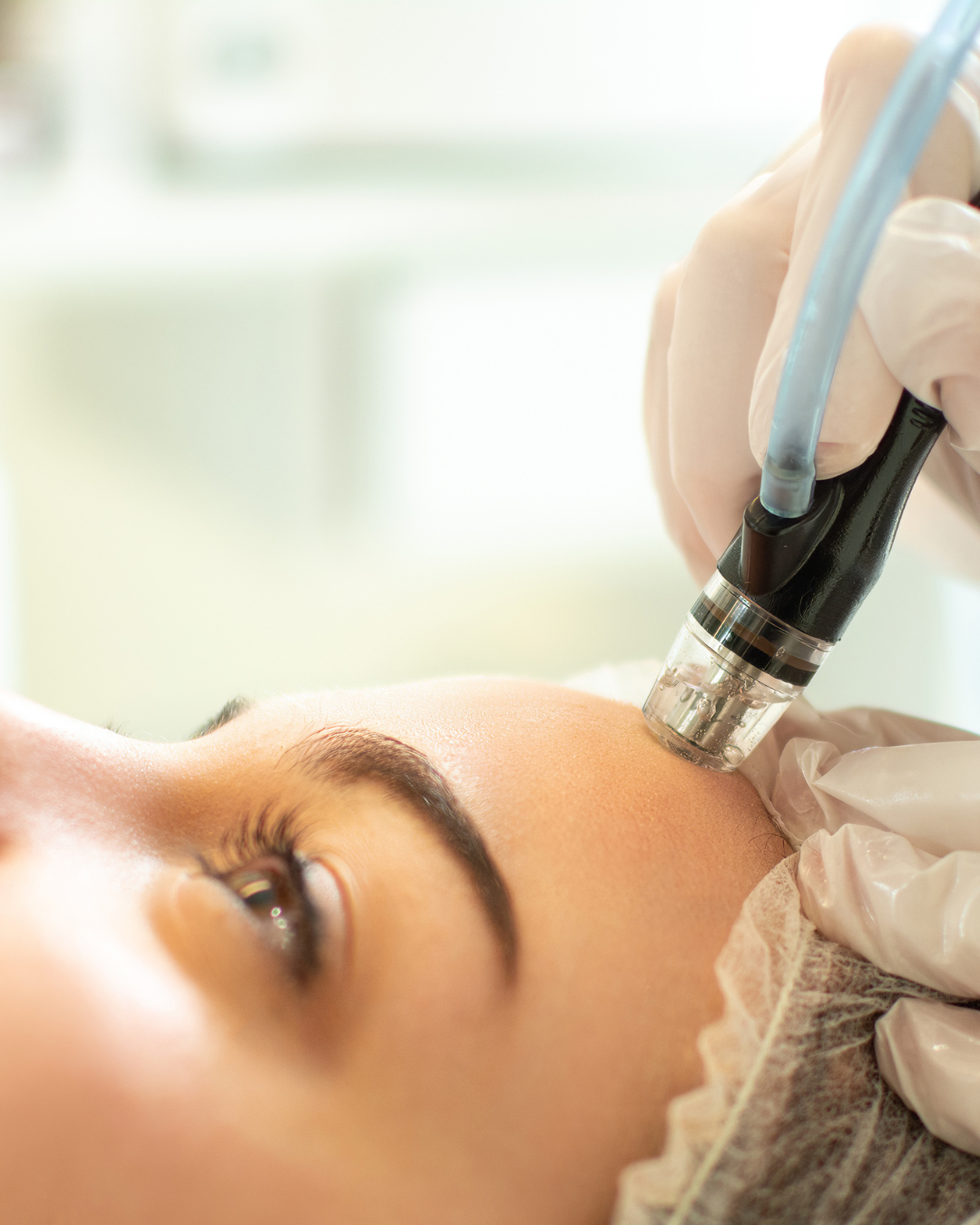 Hydrafacial Complex